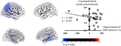 Pre-treatment Ongoing Cortical Oscillatory Activity Predicts Improvement of Tinnitus After Partial Peripheral Reafferentation With Hearing Aids